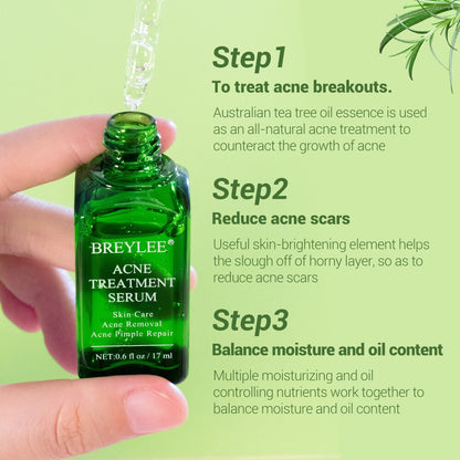 Skin Care - BREYLEE Acne Treatment Face Serum 17ml